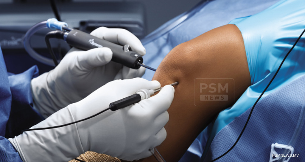 IGMH Introduces Nano Needle Surgery to Advance Joint Care in Maldives