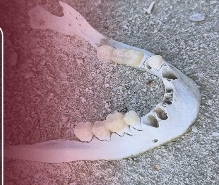 Human-like Jawbone Found Washed Ashore in Thaa Atoll